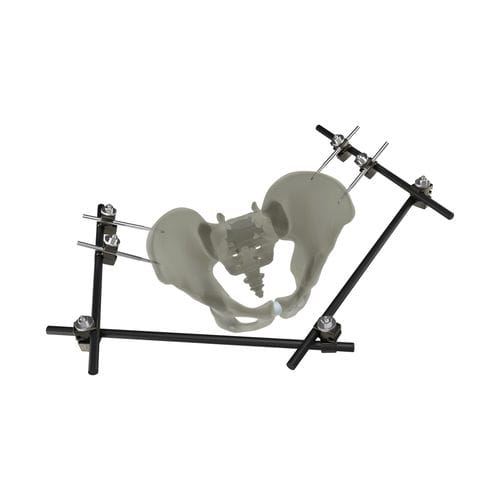 Fixateur externe / Becken - UniX® - WishBone Medical - rohrförmig / für Erwachsene