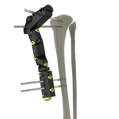 Fixateur externe / für Tibia - UniX® - WishBone Medical - für Oberschenkelknochen / für Humerus / rohrförmig