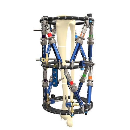 Fixateur externe / für Tibia - Smart Correction®  - WishBone Medical - für Fibula / für Humerus / ringförmig