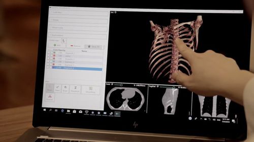 3D-Visualisierung-Software - DigiTwin - Medical Augmented Intelligence (MAI) - Diagnose / Content-Sharing / Umform