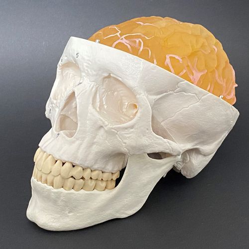 Anatomisches Modell / Tumor - Schiner3DRepro - Gehirn / für Neurochirurgie / Ausbildung