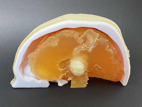 Anatomisches Schädelmodell - Schiner3DRepro - Gehirn / für Neurochirurgie / Ausbildung