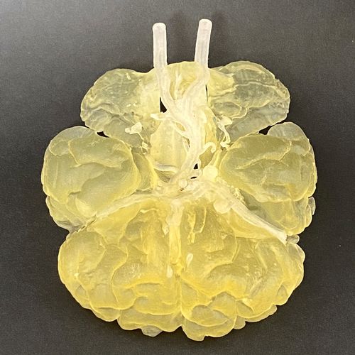 Anatomisches Modell / Arterie - Circulus Willisii - Schiner3DRepro - Circulus arteriosus Willisii / Gehirn / für Neurochirurgie