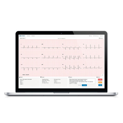 Software für EKG - Cardiobox - BMD Software - Analyse / Management / Reporting