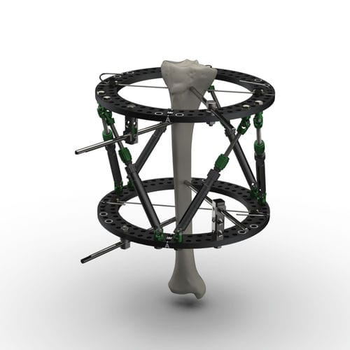 modularer Fixateur externe - TASARIMMED