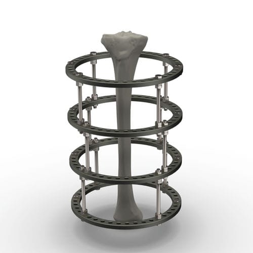 Ringförmiger Fixateur externe - SFIR series - TASARIMMED - für Tibia / für Knöchel / für Oberschenkelknochen