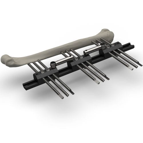 Fixateur externe / für Humerus - TF-ERS - TASARIMMED - rohrförmig / für Erwachsene / für Kinder