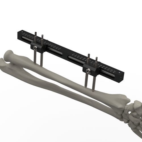 Fixateur externe / für Handgelenk - TF-ERS  - TASARIMMED - für Radius / für Ulna / rohrförmig
