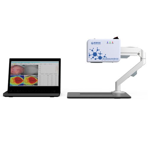 Blutfluss-Imager - Shanghai TOW Intelligent Technology