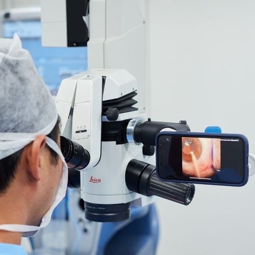 Smartphone-Adapter / für Spaltlampen - MicroREC  - Custom Surgical