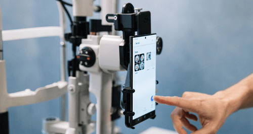 Smartphone-Adapter / für Spaltlampen - OPTIREC - Custom Surgical