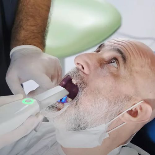 Zahnmedizinisches Material / Keramik - 3BFAB Promarket Tasarım ve Teknoloji Tic AŞ - Verbundwerkstoff / zur Dentalrestaurierung / biokompatibel