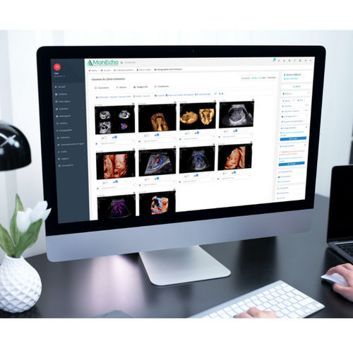 Software für Ultraschalluntersuchungen - MONECHO - MonEcho - für Arztpraxis / für Krankenhaus / für EKG