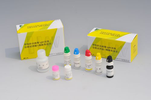 Schnelltest / Hepatitis A - Shanghai Rongsheng Biotech Co., Ltd. - IgM / ELISA