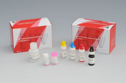 AIDS-Schnelltest - Shanghai Rongsheng Biotech Co., Ltd. - HIV / ELISA