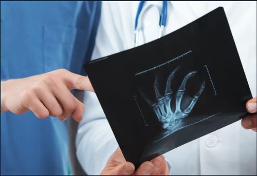 Diagnose-Software - VUNO Med®-BoneAge™ - VUNO - Bewertung / KI-gestützt / Röntgen