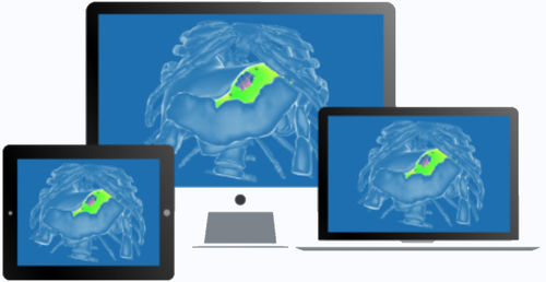 OP-Software - diSplay - InSimo - medizinisch / für Kliniken / Anatomie
