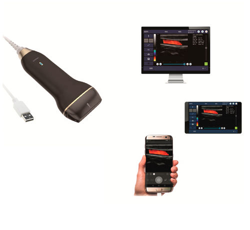 Ultraschall-Handgerät - C30L - Healson Technology - für Ultraschalluntersuchung von Muskeln und Skelett / für kutane Ultraschalluntersuchung / für intraoperative Ultraschalldiagnostik