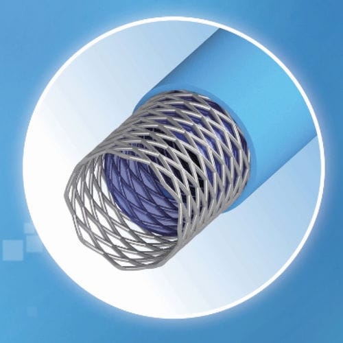 Angiographiekatheter - GRAFIA™ - Sungjin-Hitech - Herz / 5 FR / 6 FR