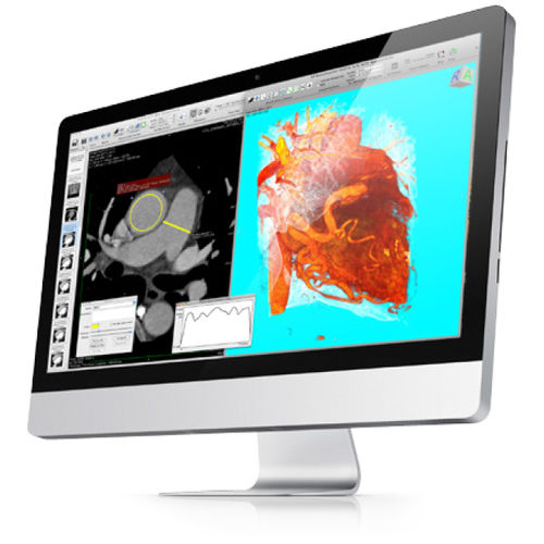 SPECT-Software - Pixmeo SARL - medizinisch / für Kliniken / für medizinische Bildgebung
