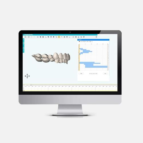 Analysesoftware - DragonOrtho  - Innovative Material and Devices, Inc. - Planung / Behandlungsplanung / Umform