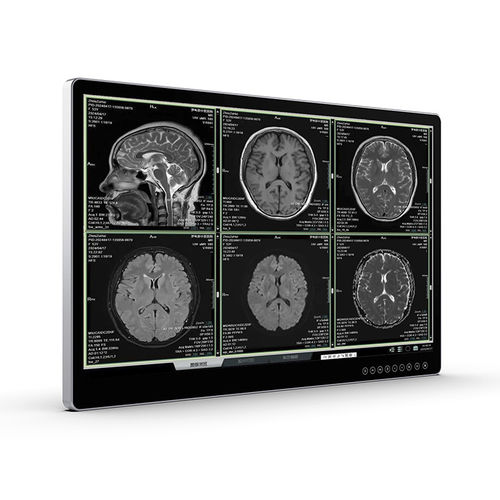 Monitor für medizinische Bildgebung - UHD Surgical Monitor - Vecoton Technology - OP / 4K / blendfrei