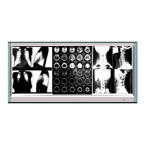 Röntgenfilmbetrachter / 3 Betrachtungsflächen - GP1003A - Bellamoon Medical - LED