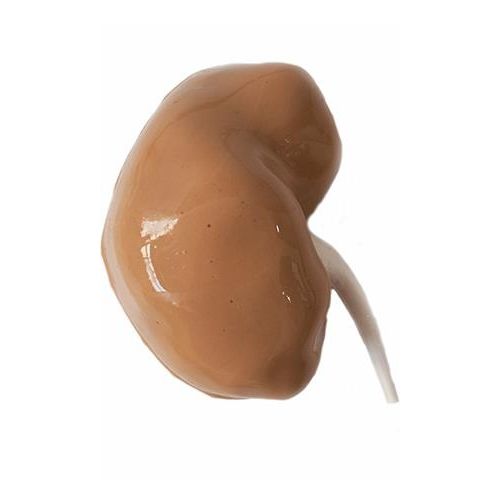 Anatomisches Modell / Niere - HSX005 - Trando 3D Medical Technology - chirurgisch / Ausbildung