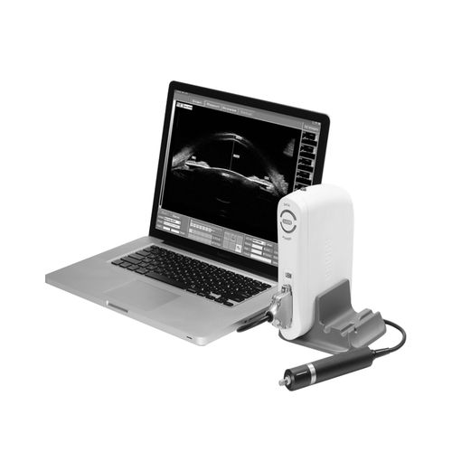 Tragbares Ultraschallgerät -  SW-3200S - Chengdu SDK Medical Science and Technology - für ophthalmische Ultraschalluntersuchungen / Schwarz-Weiß