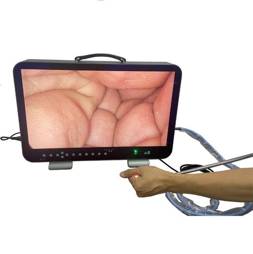 Endoskop-Kamera - E33 - Shantou Easywell Electronic Technologies - medizinisch / OP / digital