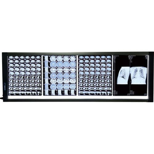 Digitaler Röntgenfilmbetrachter - MST-4000IV  - Shantou Easywell Electronic Technologies - 4 Betrachtungsfeldern / LED