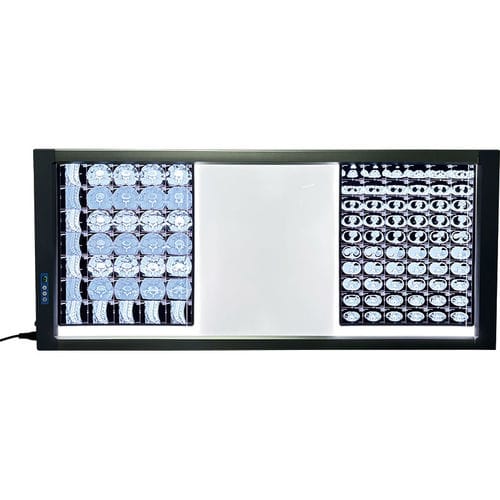Digitaler Röntgenfilmbetrachter - MST-4000III - Shantou Easywell Electronic Technologies - 3 Betrachtungsflächen / LED
