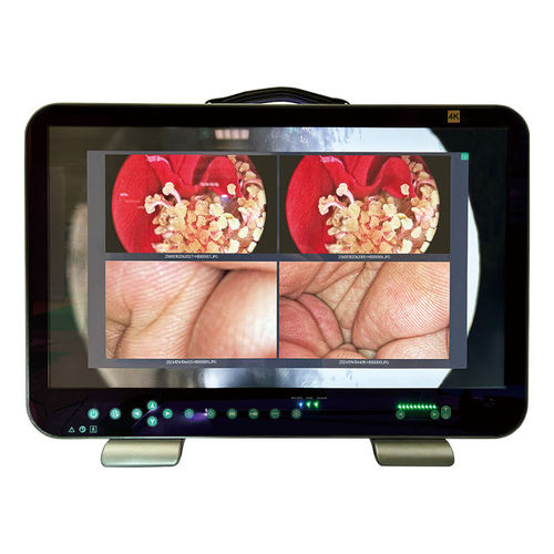 Videokamera für Endoskope - E43 - Shantou Easywell Electronic Technologies - Dental / für Veterinärmedizin / Überwachung