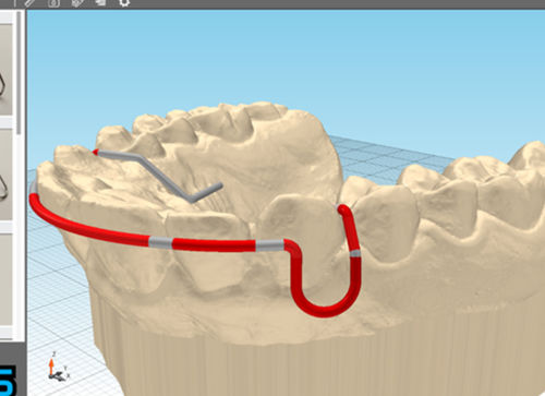 Fertigung Software - JawDraw® - Advanced Orthodontic Solutions  - Dental