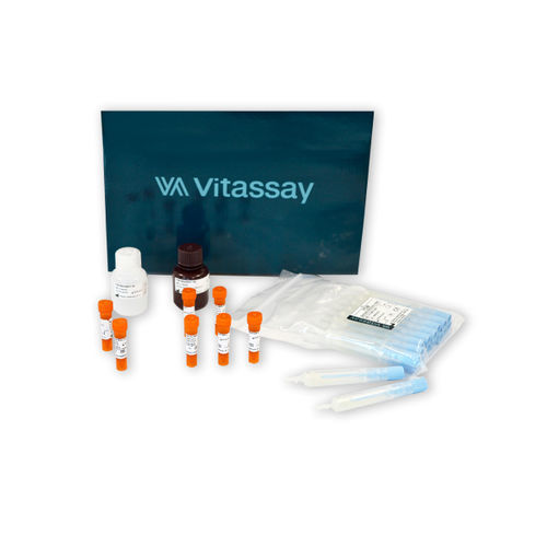 Testkit für Magen-Darm-Krankheiten - VITASSAY HEALTHCARE S.L. - Transferrin / Blut / Fäkalien