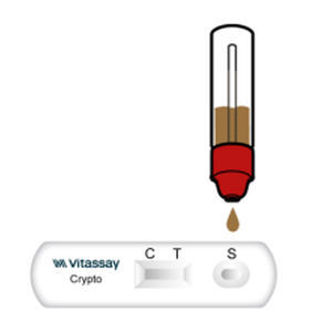 Schnelltest für Magen-Darm-Krankheiten - VITASSAY HEALTHCARE S.L. - Antigene / Cryptosporidium / Fäkalien