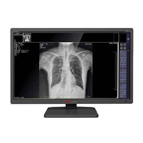 Medizinisch Monitor - MDS-C series - Shenzhen Juding Medical Equipment Co.,Ltd. - Diagnose / für medizinische Bildgebung / für Radiologie