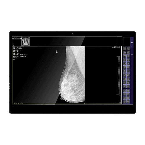 Medizinisch Monitor - IVS-8MP - Shenzhen Juding Medical Equipment Co.,Ltd. - Diagnose / für medizinische Bildgebung / Mammographie