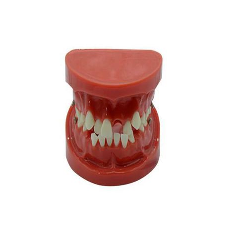 Anatomisches Modell / Gebiss - UM-B14 - Tangshan UMG Medical Instrument - für Kieferorthopädie