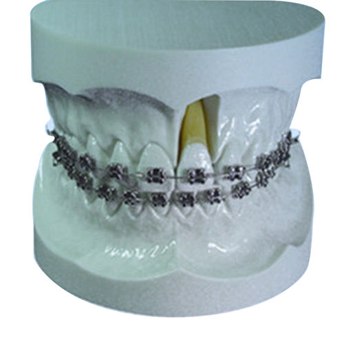 Anatomisches Modell / Gebiss - UM-S11 - Tangshan UMG Medical Instrument - für Kieferorthopädie / für Vorführzwecke
