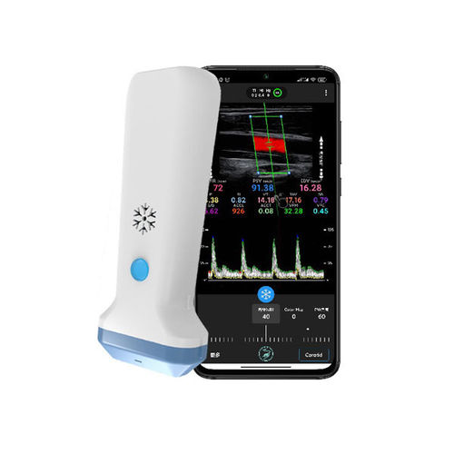 Ultraschall-Handgerät - S35L - Beijing iTrason Technologies - für ...