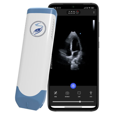 Ultraschall-Handgerät - Lite31P - Beijing iTrason Technologies - für Kardiologie / Schwarz-Weiß / Spektraldoppler
