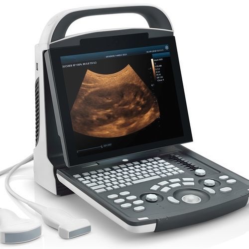 Tragbares Ultraschallgerät - DP10 - Beijing iTrason Technologies - für Multifunktions-Ultraschall / für Ultraschalldiagnostik in Gynäkologie und Geburtshilfe / für bildgebende Ultraschalldiagnostik im Bauch- und Beckenbereich