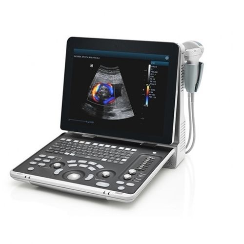 Tragbares Ultraschallgerät - Z50 - Beijing iTrason Technologies - für Multifunktions-Ultraschall / für bildgebende Ultraschalldiagnostik im Bauch- und Beckenbereich / für urologische Diagnostik