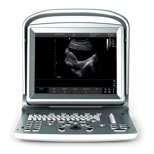 Tragbares Ultraschallgerät - eco5 - Beijing iTrason Technologies - für Multifunktions-Ultraschall / für Ultraschalldiagnostik in Gynäkologie und Geburtshilfe / für bildgebende Ultraschalldiagnostik im Bauch- und Beckenbereich