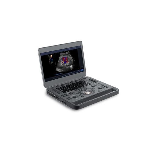 Tragbares Ultraschallgerät - X3 - Beijing iTrason Technologies - für Multifunktions-Ultraschall / für Ultraschalldiagnostik in Gynäkologie und Geburtshilfe / für bildgebende Ultraschalldiagnostik im Bauch- und Beckenbereich
