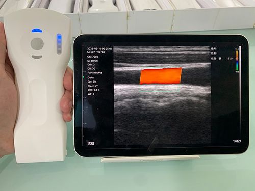Ultraschall-Handgerät - CL - Beijing iTrason Technologies - für Ultraschalldiagnostik in Gynäkologie und Geburtshilfe / für bildgebende Ultraschalldiagnostik im Bauch- und Beckenbereich / für urologische Diagnostik