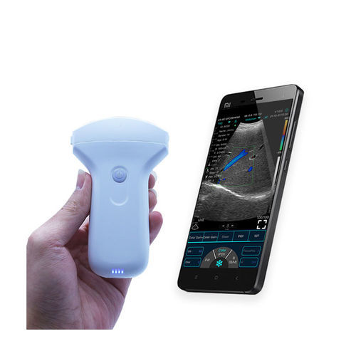 Ultraschall-Handgerät - C10UR - Beijing iTrason Technologies - für Multifunktions-Ultraschall / für Ultraschalldiagnostik in Gynäkologie und Geburtshilfe / für bildgebende Ultraschalldiagnostik im Bauch- und Beckenbereich
