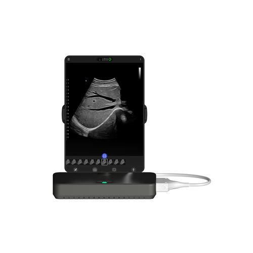 Tragbares Ultraschallgerät - Cloud - Beijing iTrason Technologies - für Multifunktions-Ultraschall / für Ultraschalldiagnostik in der Notfallmedizin / für Brust-Ultraschall