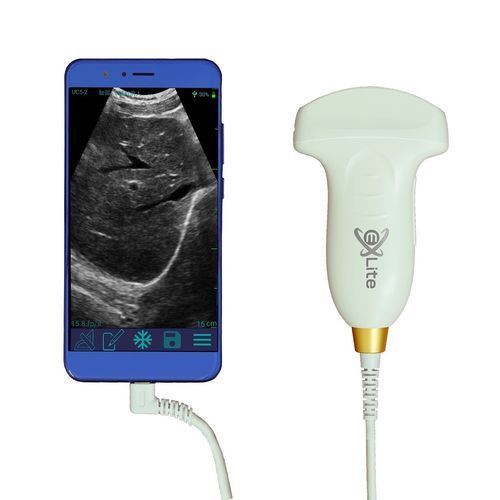 Konvexe Ultraschallsonde - UC5-2 - Beijing iTrason Technologies - Bauch / Geburtshilfe/Gynäkologie / urologisch